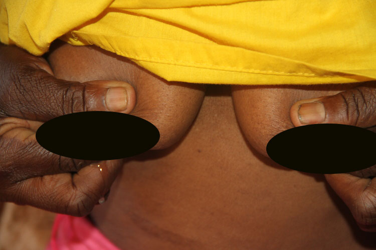 Oyamwiwa nechipoko