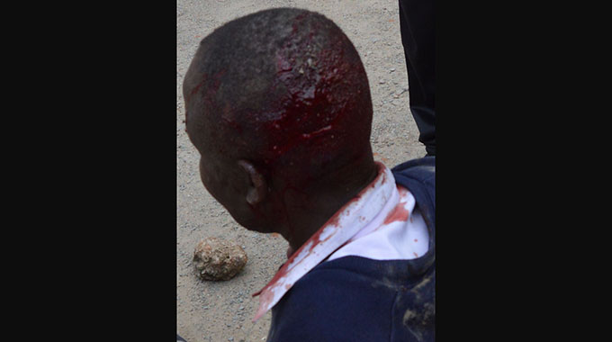 EDITORIAL COMMENT: MDC-T culture of violence barbaric