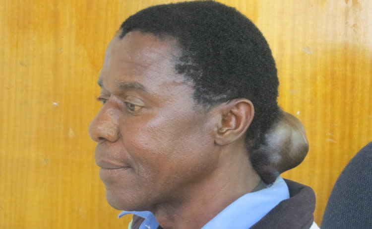 Oyaura nezibundu mumusoro