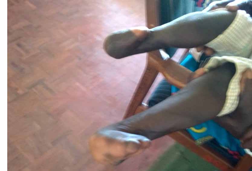 NEW: Girl (4) in dire need of special shoes
