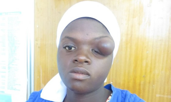 Mudede atambura nebundu