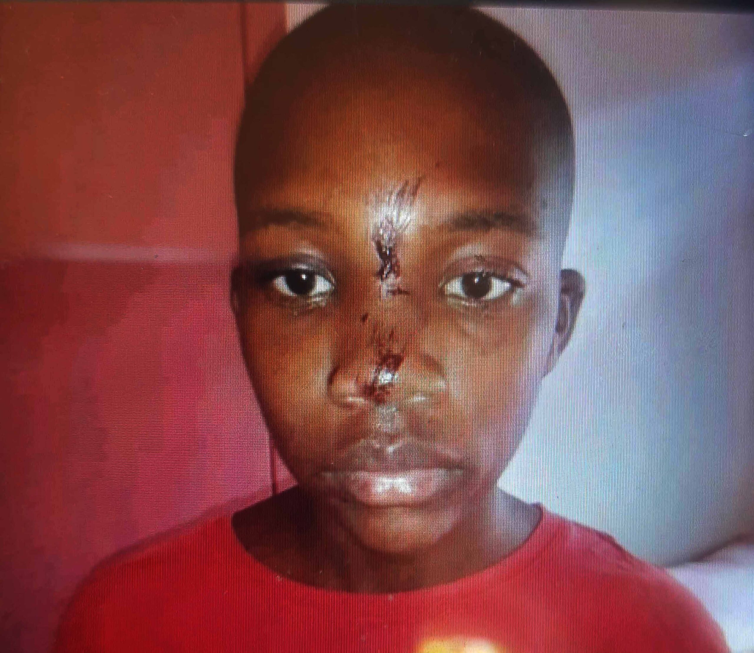 The late Rufaro Nyamangodo's bruised face