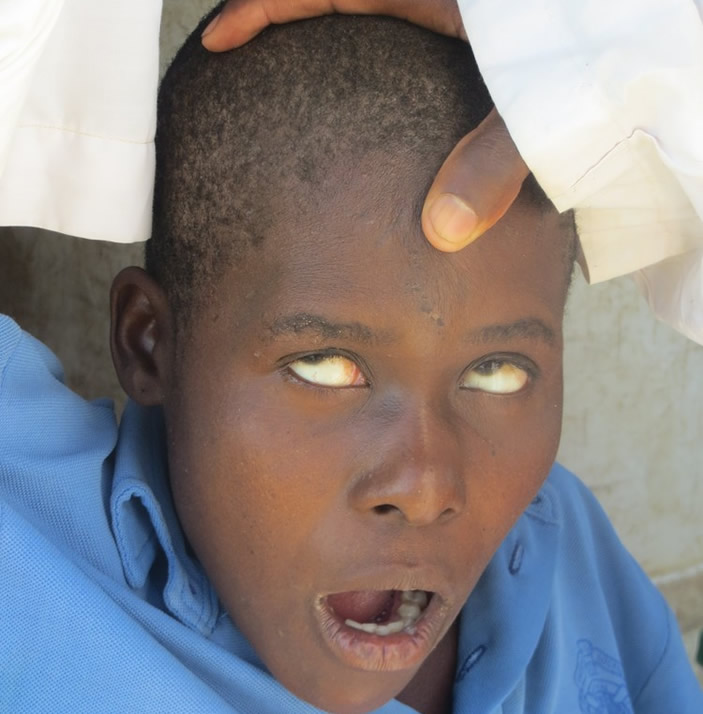 Anodaidza nyoka dzichiuya