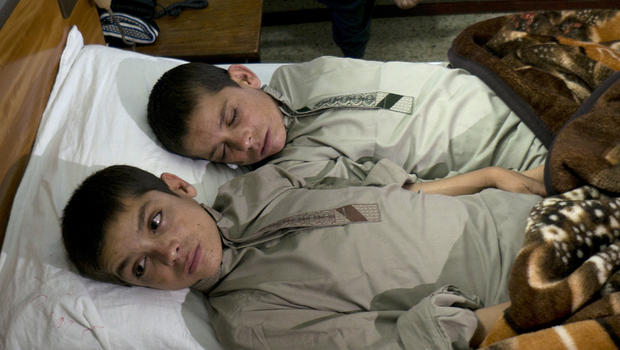 ‘Solar kids’ mystify doctors