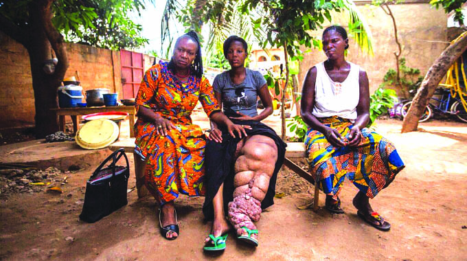 Neglected Tropical Diseases: Patients yearn to be heard in decision-making