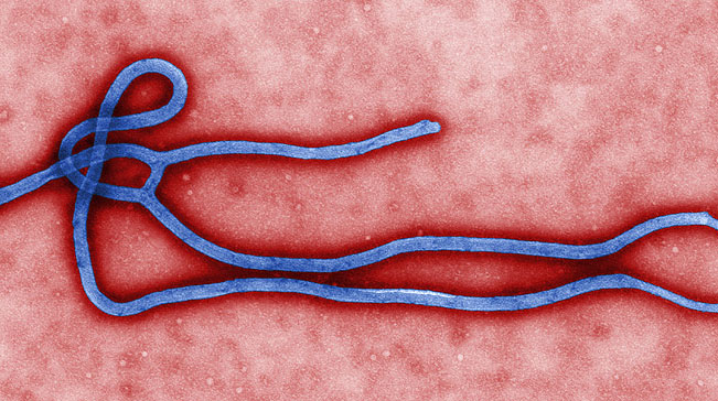 Ultra-secure lab in Gabon equipped for Ebola studies