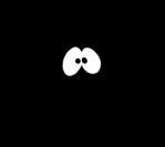 Zesa system disturbance plunges city into darkness