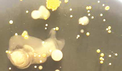 Hidden bacteria lurking on phones