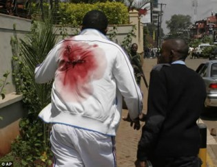 An injured man is led out of the mall