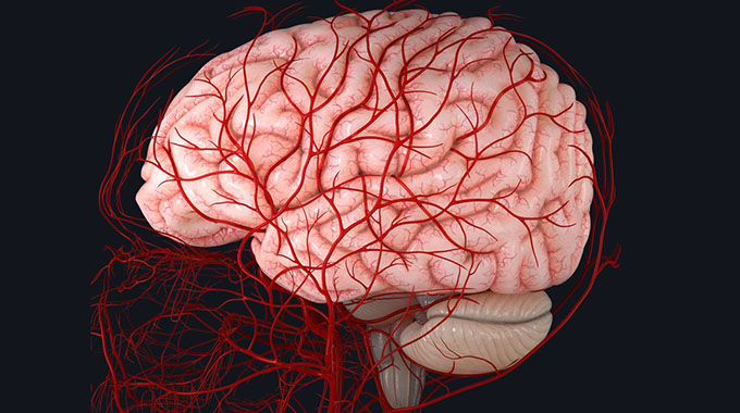 Study finds new evidence of SARS-CoV-2 damaging brain blood vessels