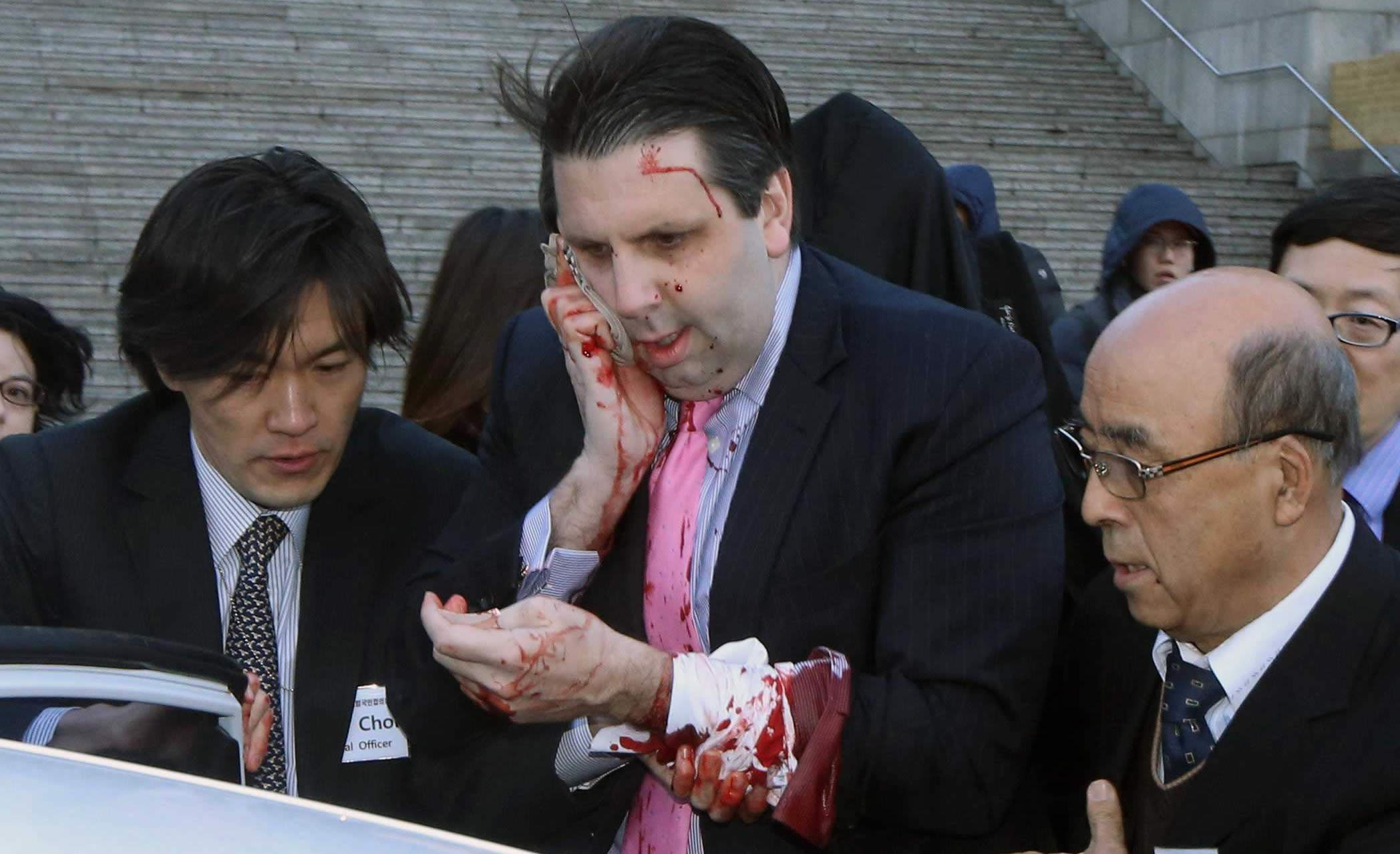Activists attacks US ambassador