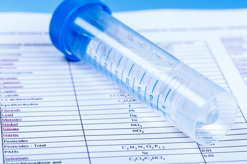 Zinwa to embark on water quality tests countrywide