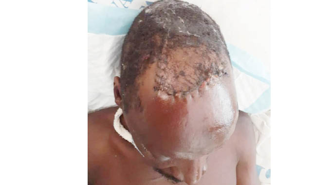 Miner left for dead over gold