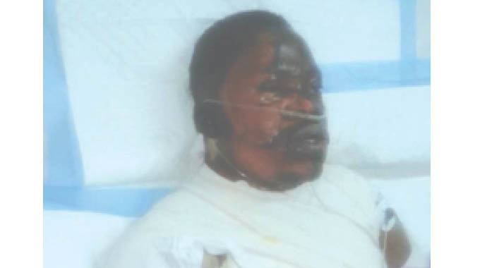 Uthelwe ngephethulo watshiswa ‘ojolayo’