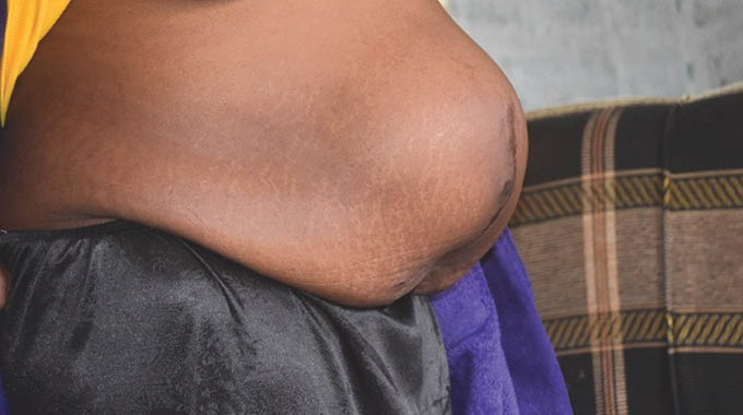 Usephenduke inhlekisa okhukhunyalelwa yisisu . . . ‘Sengifana lento exotshwe kwathiwa iyofela kude’