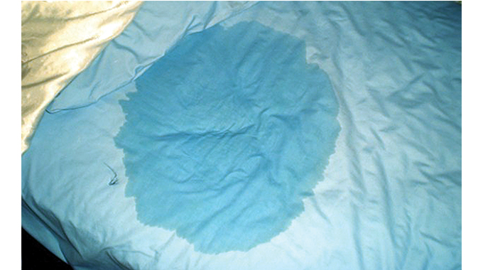 Woman divorces bedwetting hubby