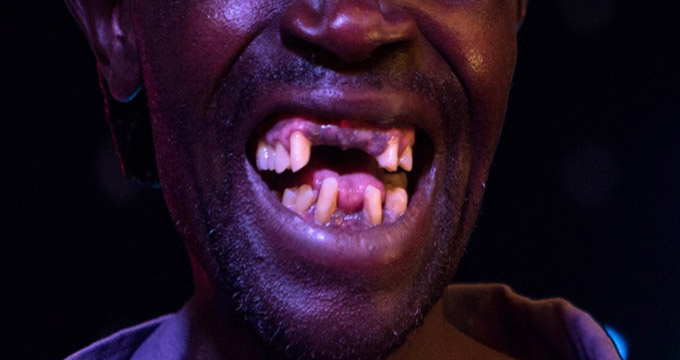 Man loses teeth in cabbage brawl