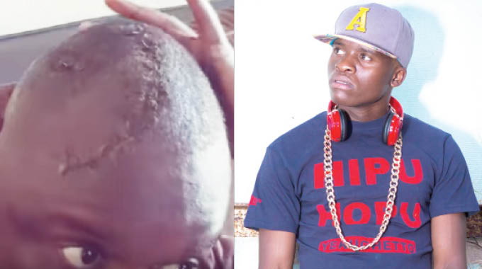 Ti Gonz traumatised by mugging