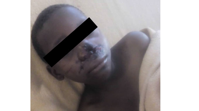 Kuqhuma ‘ibhomba’ kulimale abathathu eTsholotsho
