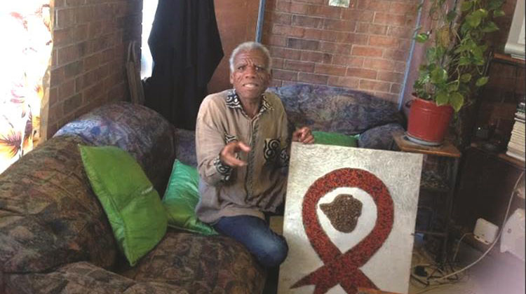 Scarred but unbowed by HIV