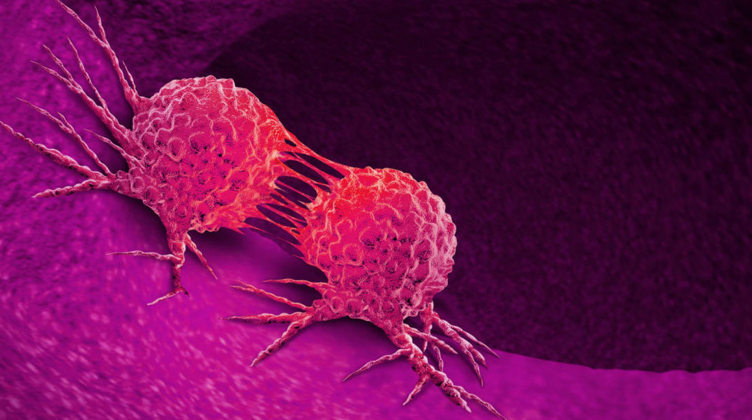 Cancer should not be ignored