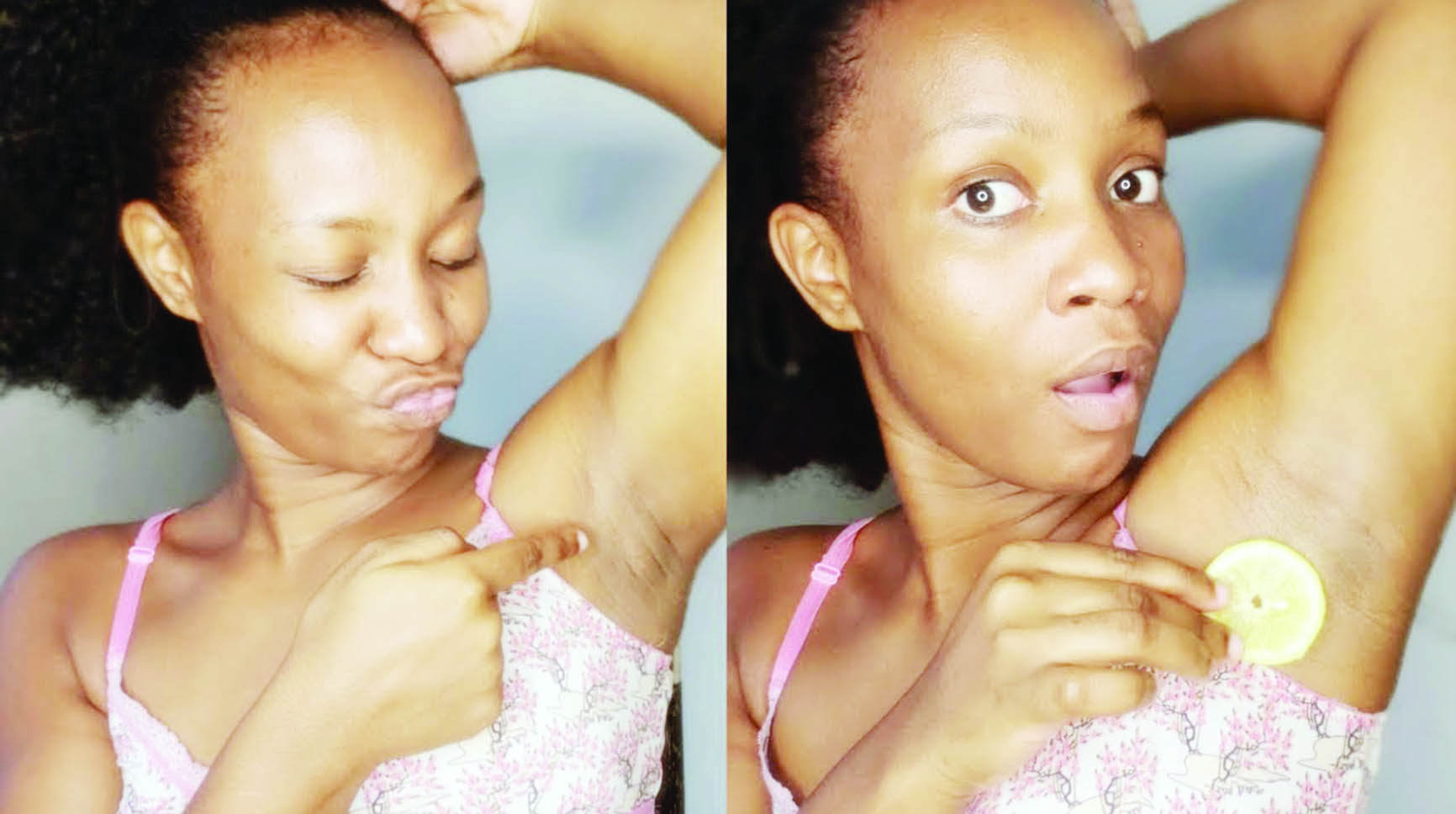How to get rid of underarm odour