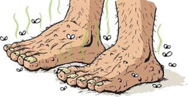 DEALING WITH SMELLY FEET IN SUMMER