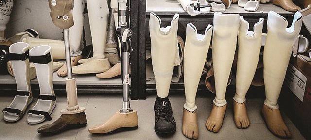 Prosthetics industry future bleak