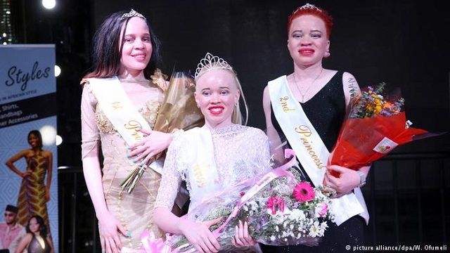 Mutukura scoops Miss Albinism