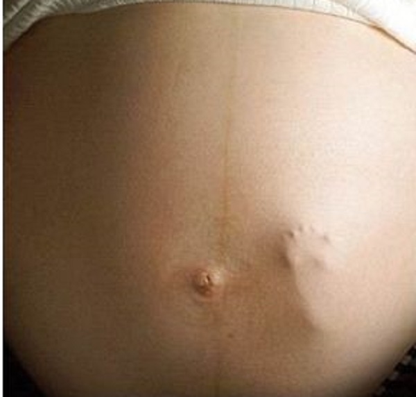 The pain, anguish of infertility