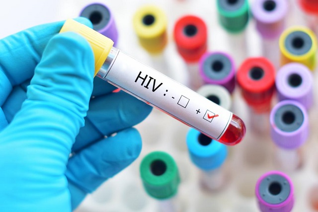 No known cure for HIV –WHO