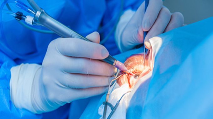 UBH to offer free eye surgeries