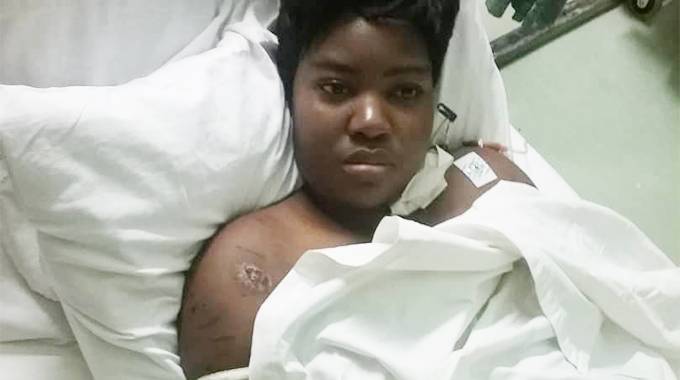 Dog-mauled woman learns to walk again