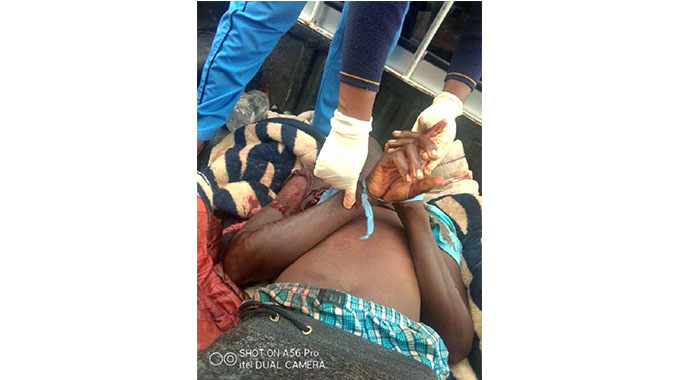 Man shot three times as police search for armed robber