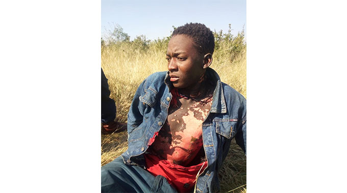 Zesa cables thief battles for life