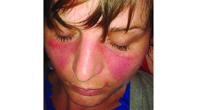 When your body attacks itself. . . Arm yourself with knowledge on Autoimmune Diseases