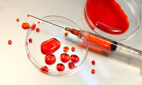 The ‘Bloody Fix’…Drug users injecting each other’s blood ‘bluetoothing’ fad takes over the streets