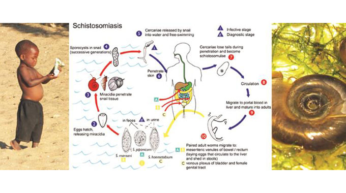 Zimbabwe set to eliminate bilharzia
