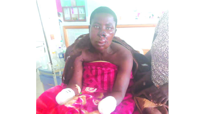 Hyena victims appeal for help