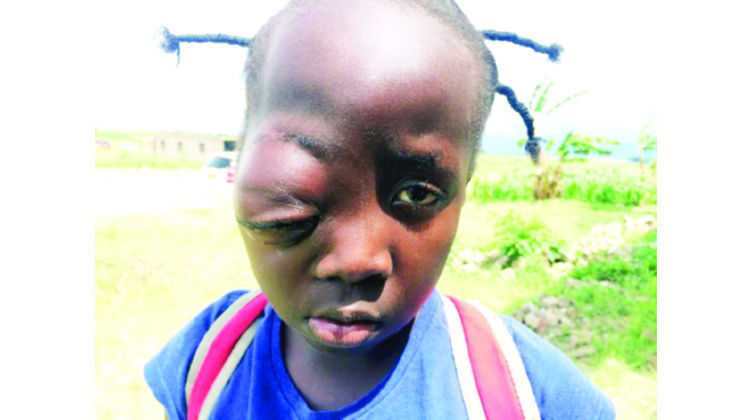 Mother seeks funds for child op in India