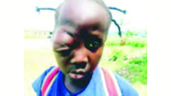 Girl undergoes successful eye op