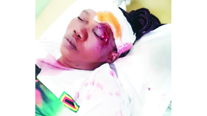CCC supporters attack, badly injure Zanu PF members