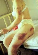 Murehwa teenager rapes 99-year-old granny