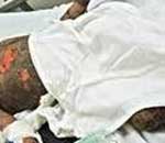 Kid burnt during church healing session