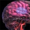 Stroke a ‘brain attack’