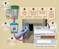 Ray of hope for TB patients . . .