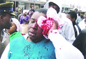 Osiphatheleni beat up bogus cop