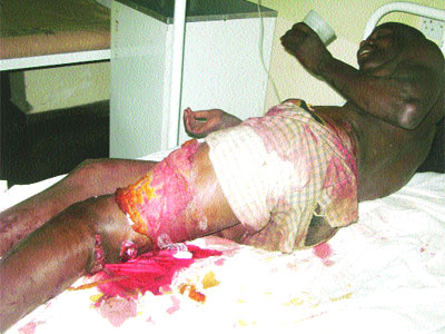 Border jumper survives crocodile attack