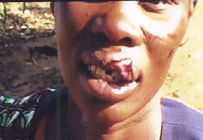 Gender-based violence up