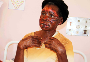 Woman survives inferno